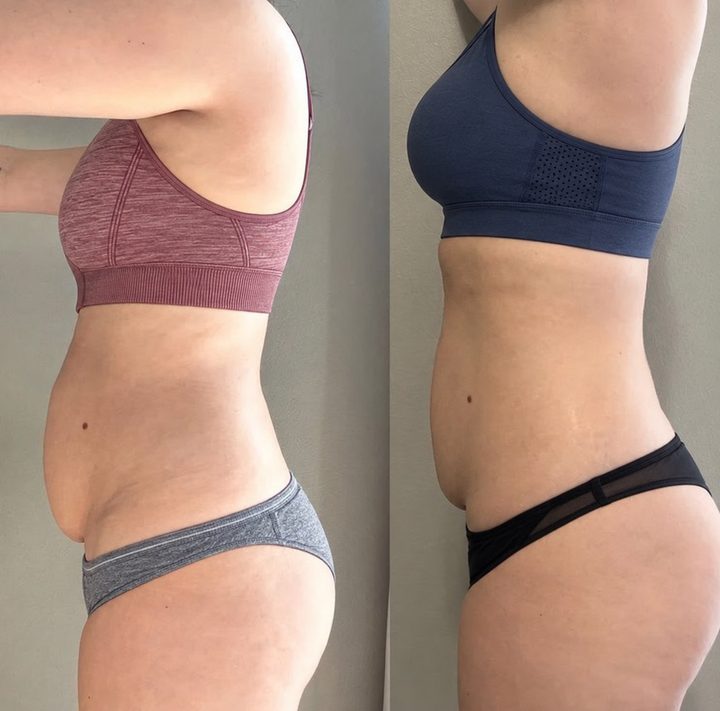 Before and after, a mother who followed the method